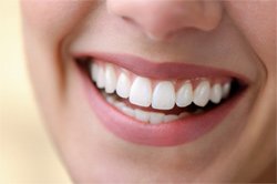 Get a beautiful smile using cosmetic dentistry with a Salt Lake City dentist Murray UT and Sandy Utah