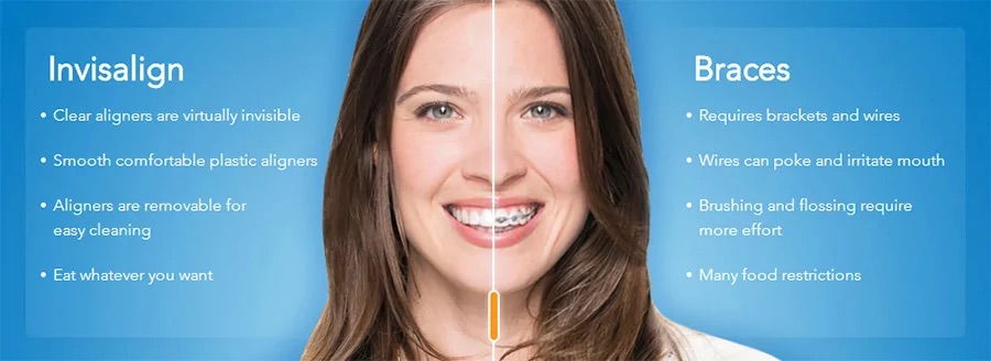 invisalign vs braces and metal braces with a Murray dentist in Salt Lake City and Sandy Utah