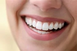 Six Month Smiles and adult orthodontics with a Murray dentist Salt Lake City and Sandy Utah